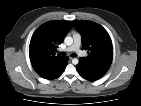image-What is an axial cavity?