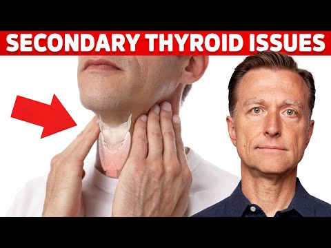 Most Thyroid Issues Are Secondary to Other Problems – Dr. Berg