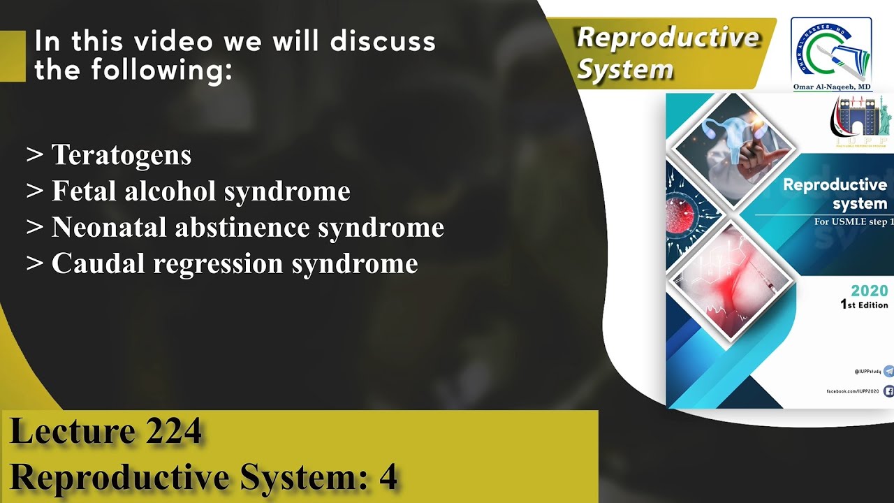 Teratogens | Fetal alcohol syndrome | Neonatal abstinence syndrome | Caudal regression syndrome