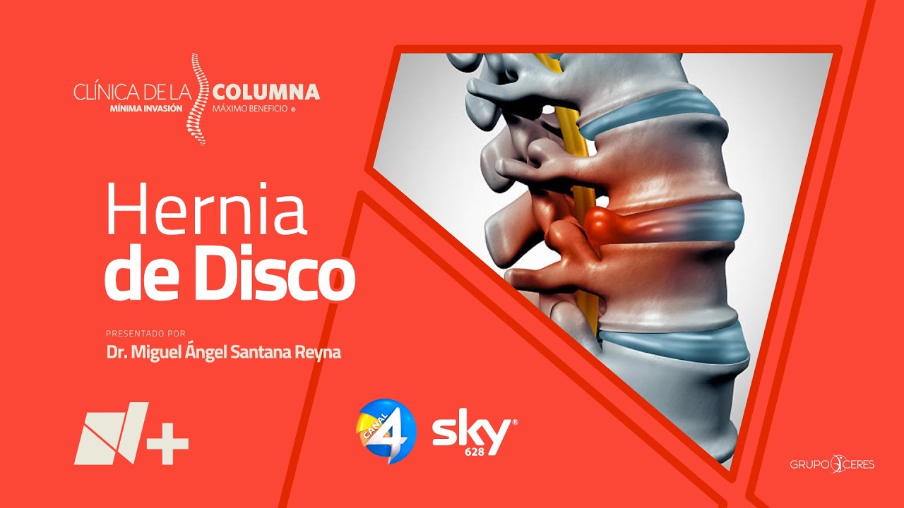 Miguel Angel Santana Reyna-7