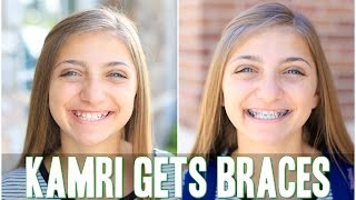 Kamri Gets Braces! | Behind the Braids Ep.4