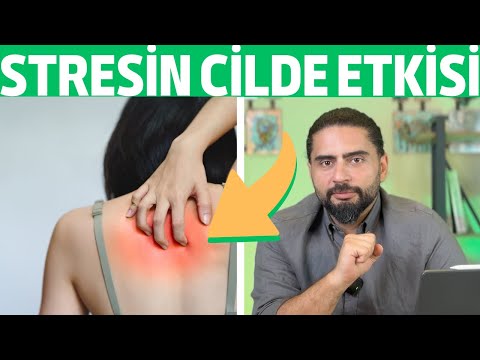 STRESİN CİLDE ETKİSİ - SİVİLCELER, EGZAMA, SEDEF HASTALIĞI - NEDEN OLUR?