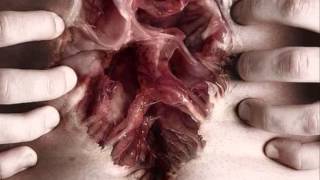 Burial - You Hurt Me