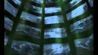 Dolphin's Mind - L' Esperanza (Original Music Video)