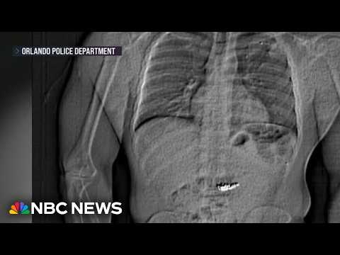 Florida man who swallowed $769,000 in Tiffany diamonds found guilty