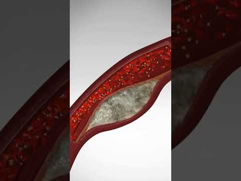 Guess The Spine Injury And Procedure Challenge