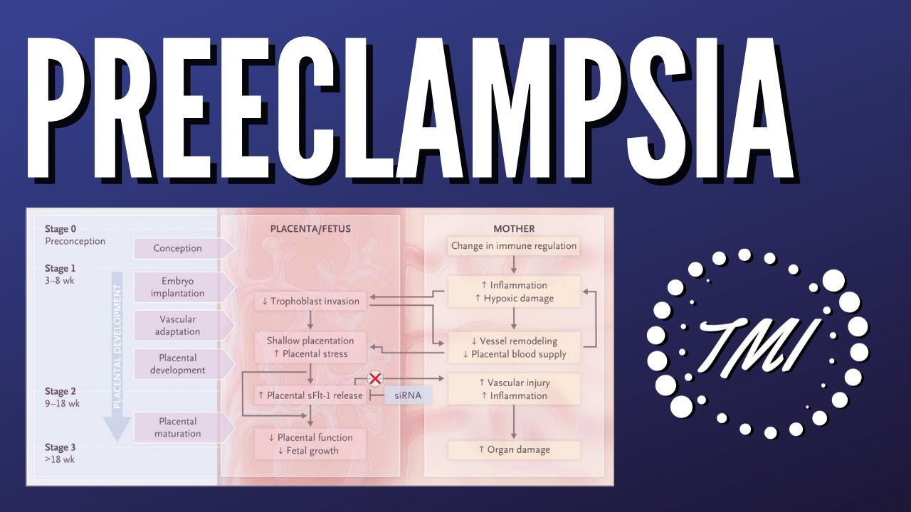 Preeclampsia Explicada Claramente