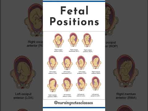 types of fetal positions easy notes for nursing students #fetal #positions #types #obg #nursing