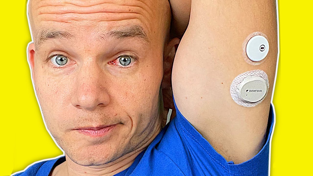 FreeStyle Libre 3 vs Dexcom G7 | Full Test & Review