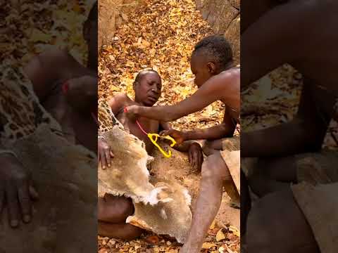 Doctor Check-Up Turns Into Comedy || by Chaba. #hadzabeculture #chaba #triballife #funny #africa