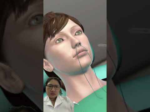 Illustration of sinus surgery #p1 #doctor #3danimationsurgery #animation #animation