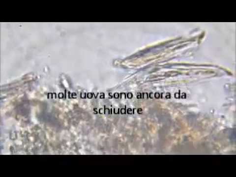 Trattamento di medicine lyambliya Come bere lolio di ricino per chiarificazione di intestini da parassiti