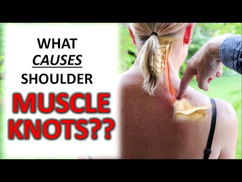 What CAUSES Muscle Knots In Your Shoulders, Traps & Upper Back?