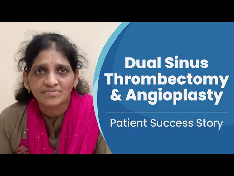CVST Treatment with Dual Sinus Thrombectomy in Visakhapatnam | Medicover Hospitals - Video Thumbnail