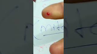 Download lagu #sugar test #glucometer mp3