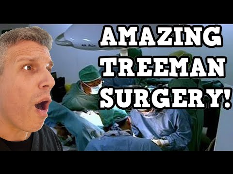 Dermatologist reacts to My Shocking Story - Treeman Surgery