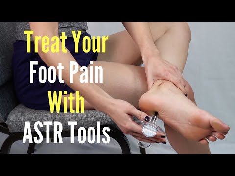 Treat Your * Plantar Fasciitis * & Foot Pain With ASTR Tools