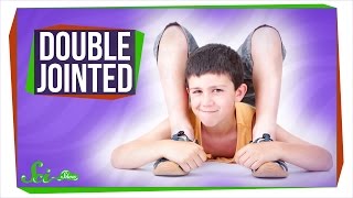 Why Are Some People Double-Jointed?