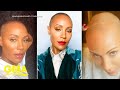 Jada Pinkett Smith Opens Up About Her Experience With Hair Loss L GMA