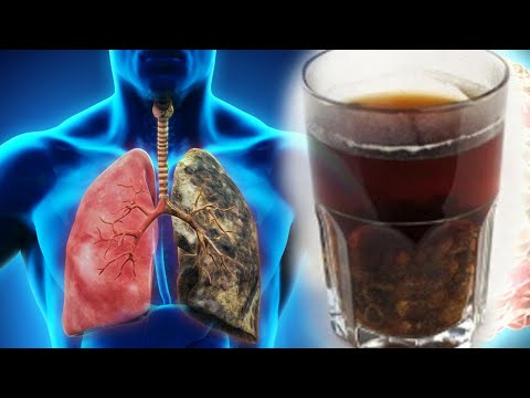 Këto 6 shenja tregojnë se mëlçia juaj nuk po punon siç duhet, mos i injoroni