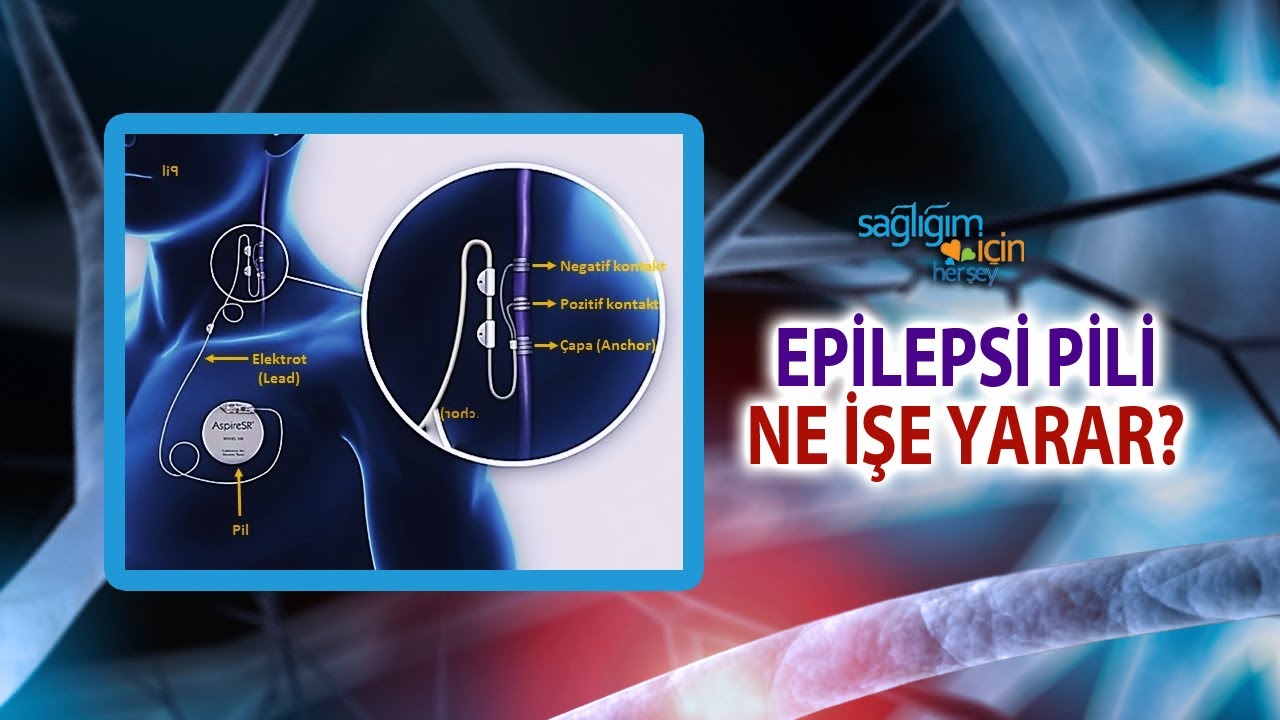 Akıllı Epilepsi Pili, Etkisini Ne Zaman Göstermeye Başlar?