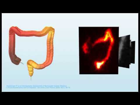 Coloplast | Scintigrafische beelden