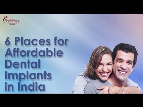 Top 6 Budget-Friendly Dental Implant Locations in India