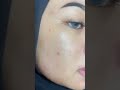 Skincare Mustika Ratu