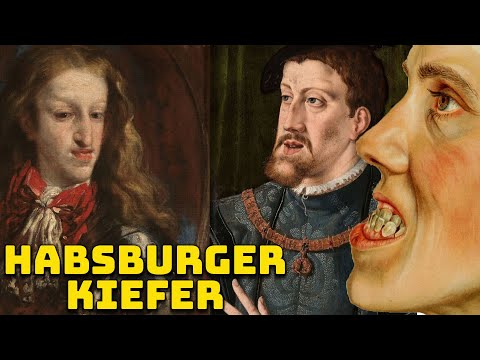Die Grotesken Kiefer der Habsburgischen Adligen – Habsburger Kiefer