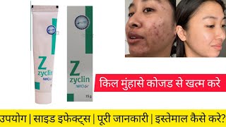 Zyclin Nano Gel is an effective medicine for treating pimples and acne. Uses, Side Effects, how t...