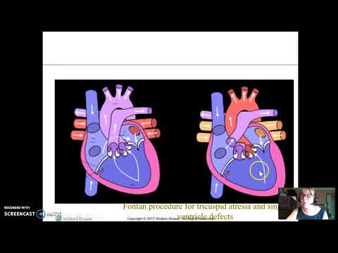 Perfusion Cardiac Part 3