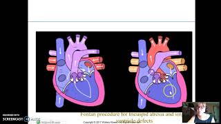 perfusion/cardiac part 3