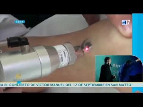 download lagu mp3 mp4 Tatuaje Asturias, download lagu Tatuaje Asturias gratis, unduh video klip Tatuaje Asturias