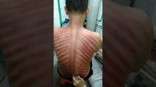 Download lagu Trik cara kerokan yang benar di jamin anggin hilang #ragil #shortsvideo #viral mp3 Download lagu Trik cara kerokan yang benar di jamin anggin hilang #ragil #shortsvideo #viral mp3