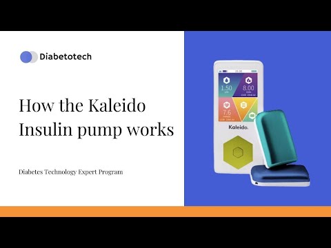 Diabetotech | Kaleido Insulinpumpe: So funktioniert sie | Expertenprogramm für Diabetestechnologie