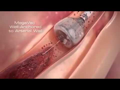 download lagu mp3 mp4 Block Hart, download lagu Block Hart gratis, unduh video klip Block Hart