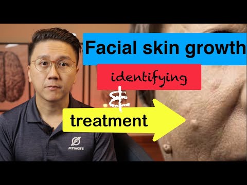 Growths on YOUR Face - Identifying and Treatment (Part 1/2)