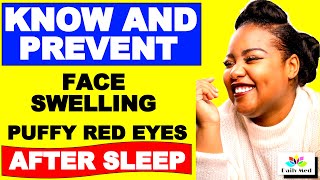 What Causes Face SWELLING And  PUFFY RED EYES After SLEEP || Daily MED Facts Of Human Life
