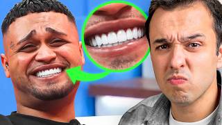 DİŞ DOKTORU, ÜNLÜLERİN DİŞ TEDAVİLERİNİ YORUMLUYOR !
