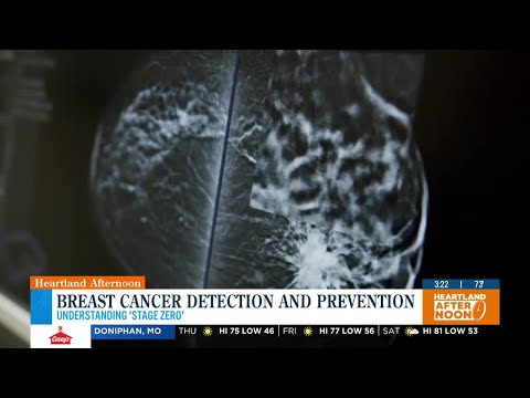 Doctor explains 'stage zero' breast cancer detection and prevention