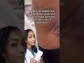 Underarm Rash And Pigmentation From Natural Deodorant