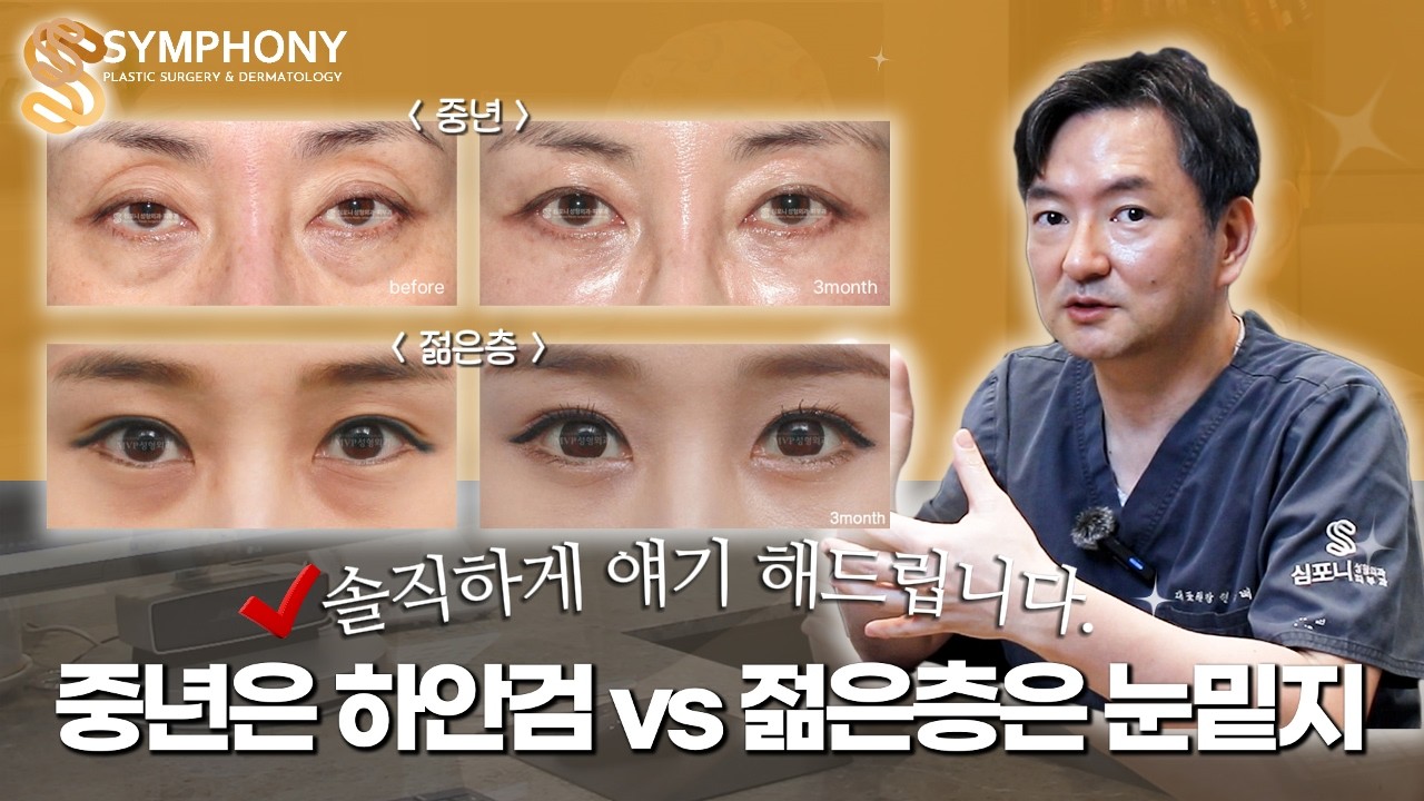 중년은 하안검 vs 젊은층은 눈밑 지방 재배치 솔직히 얘기해드립니다