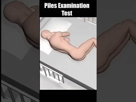 Examination of Piles by a Surgeon 3d animation #shorts