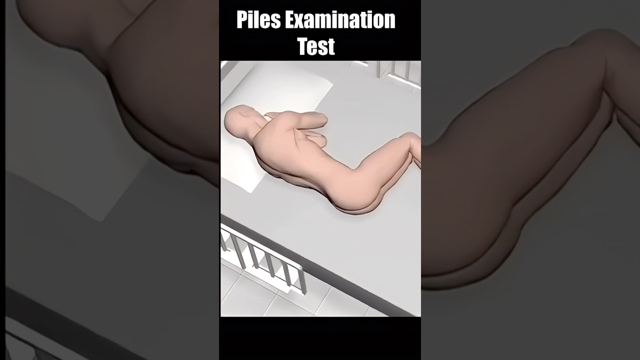 Examination of Piles by a Surgeon 3d animation #shorts