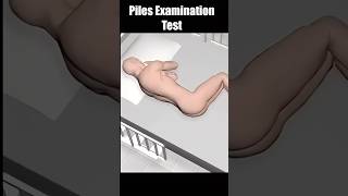 Examination of Piles by a Surgeon 3d animation #shorts