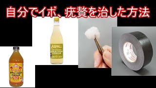 足底疣贅、いぼを治した方法