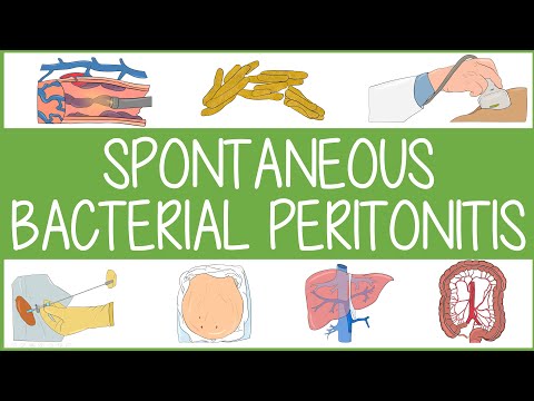 Spontane bakterielle Peritonitis – visuell erklärt