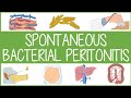 Spontaneous Bacterial Peritonitis Visually Explained