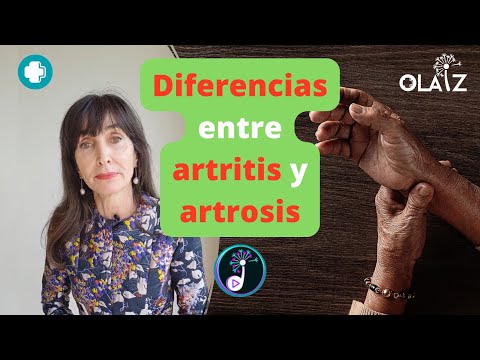 DIFERENCIAS ENTRE LA ARTRITIS Y LA ARTROSIS