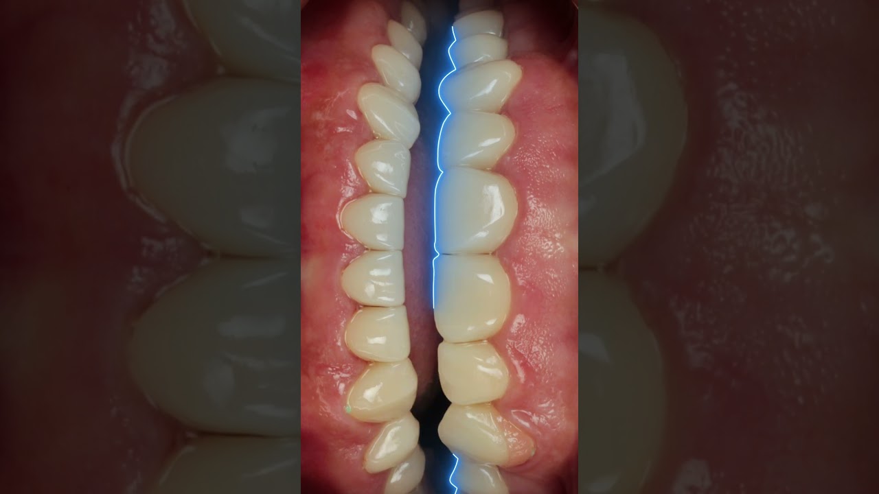 Full motion dental case video example two